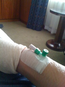 cannula
