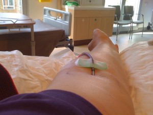 needle in arm